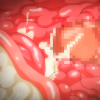 Thumbnail of related posts 047